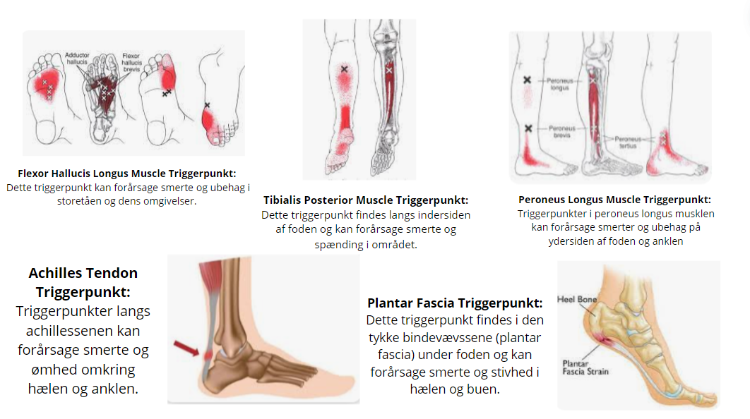 triggerpunkter til ondt i fødderne
